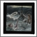 [thumbnail of Bible illustrations temperance meetings lantern slide box]